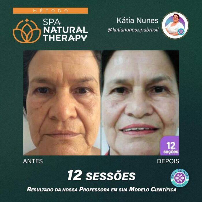 Método SPA NATURAL THERAPY depoimento